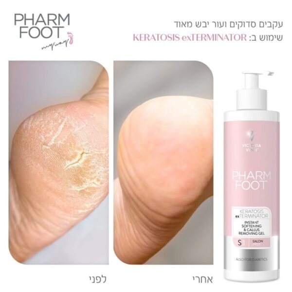 ⁦Pharm Foot | KERATOSIS exTERMINATOR ג’ל ריכוך להסרת קאלוס ועור יבש⁩ – תמונה ⁦2⁩